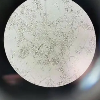 After high-pressure homogenization