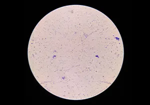 Lactobacillus cell disruption